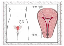 子宮出血如何醫(yī)治？